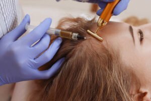 Recovery Timeline and What to Expect Day by Day PRP Hair Treatment in Islamabad: