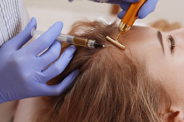 Recovery Timeline and What to Expect Day by Day PRP Hair Treatment in Islamabad: