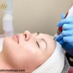 Potenza Microneedling Near Me