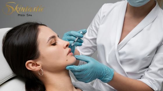 Lip Fillers Riverside